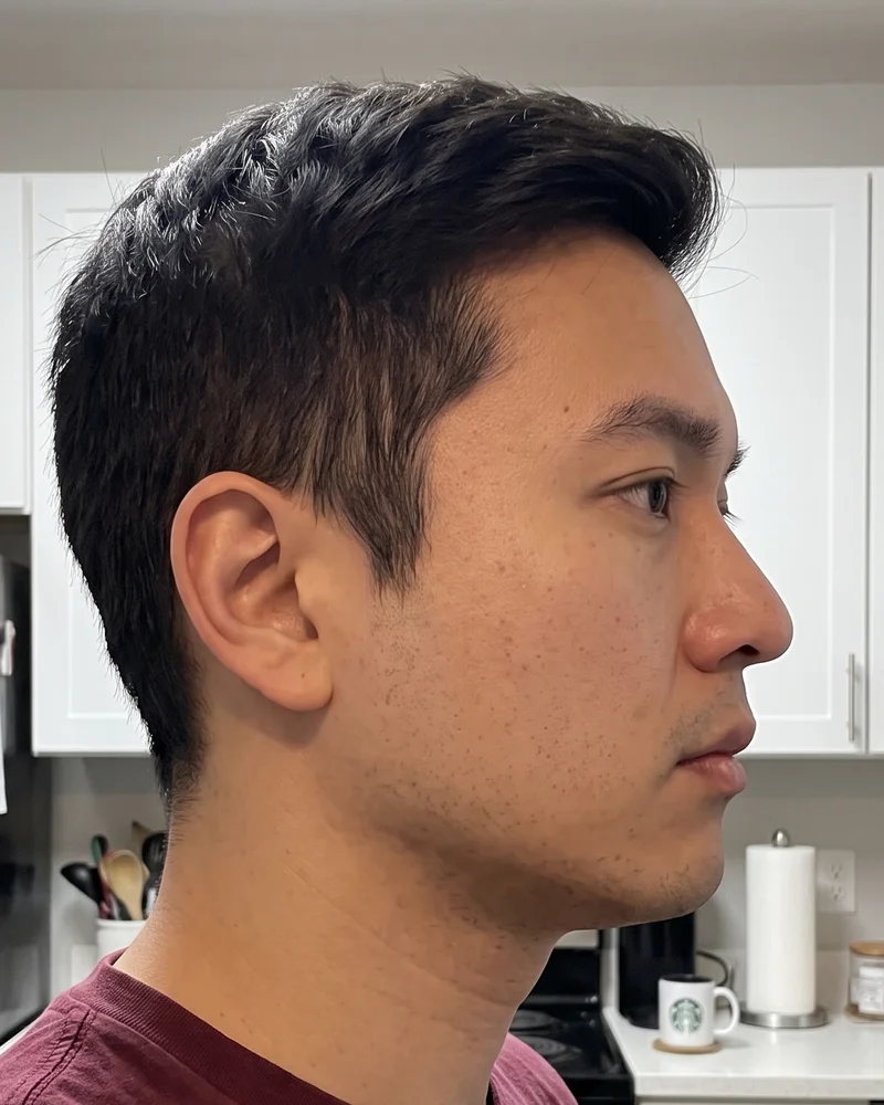 Ilustração do mesmo perfil antes e depois: depois