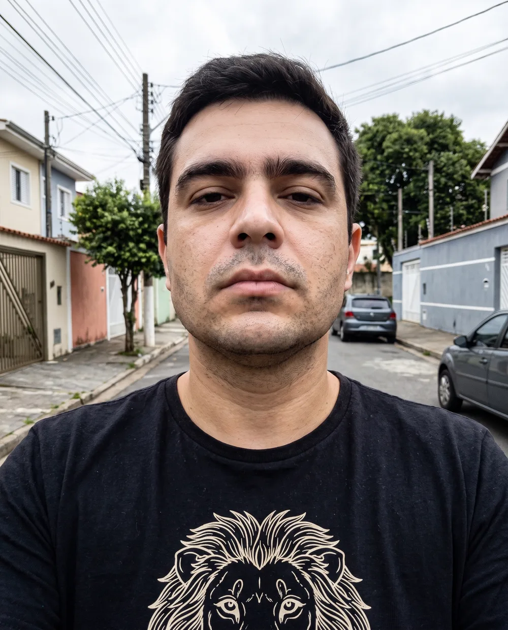 Depois: o mesmo homem com maxilar mais definido e queixo marcado